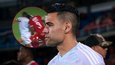 Millonarios confirma lesión grave de Falcao en el rostro