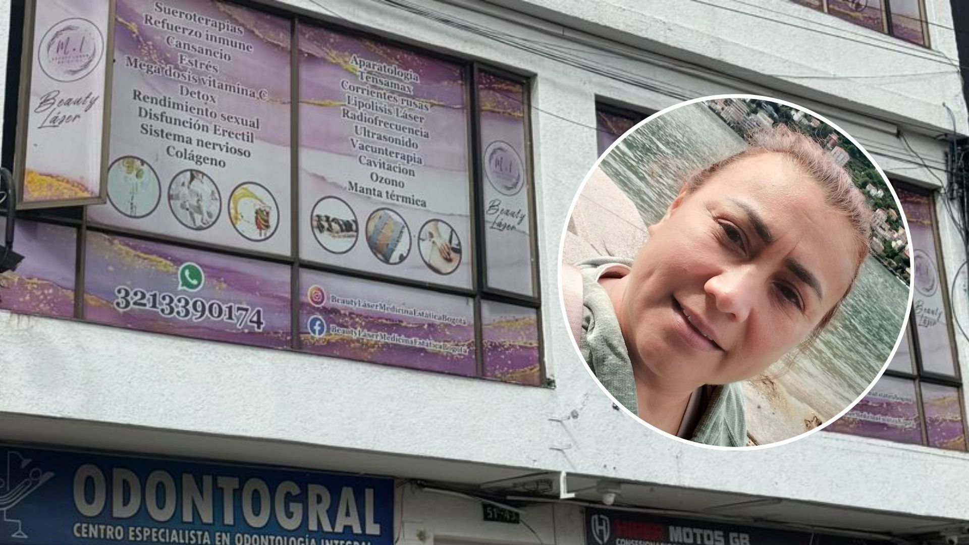 Yulixa Toloza y el centro estético de garaje en Bogotá