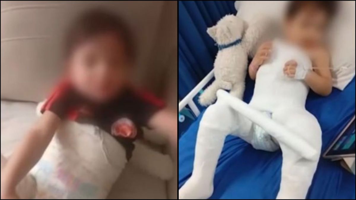 Niño de 2 años está postrado tras fractura en jardín del ICBF en Bogotá.