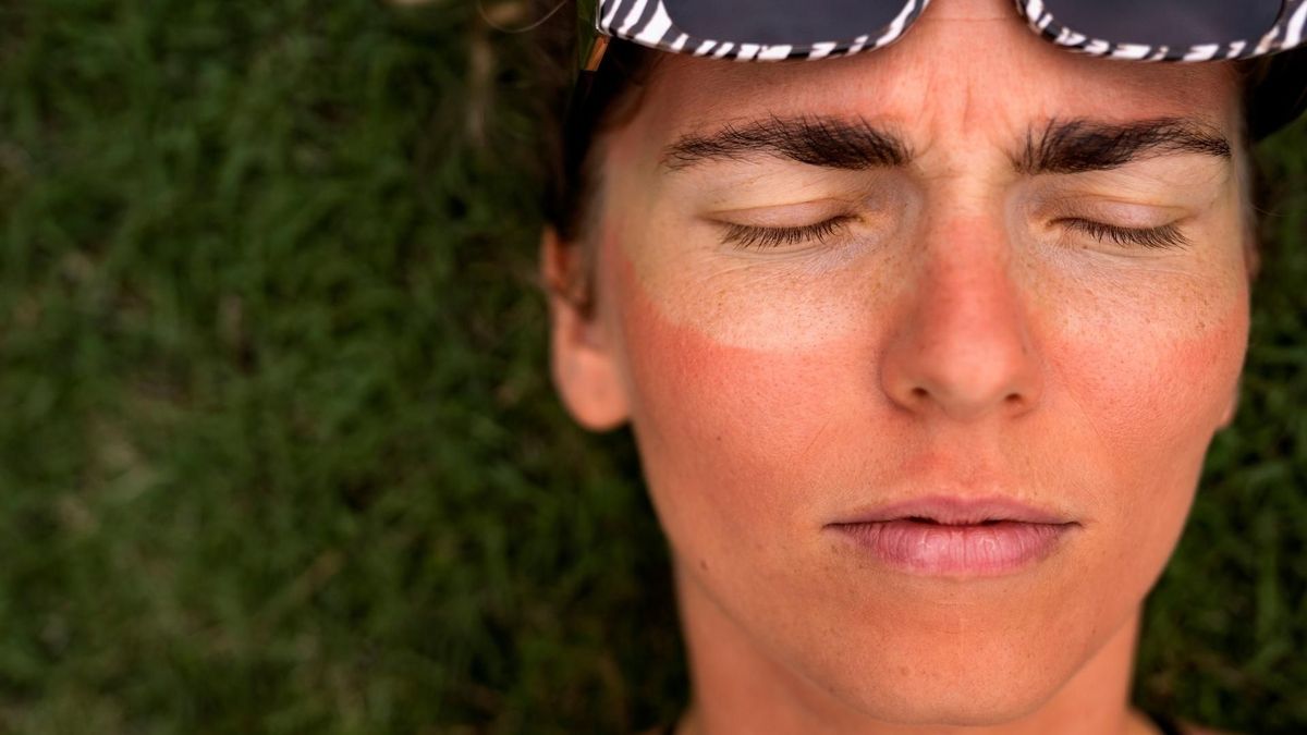 La dermatóloga Slendy Torres advierte sobre los riesgos del sol extremo en la piel durante el Fenómeno de El Niño.