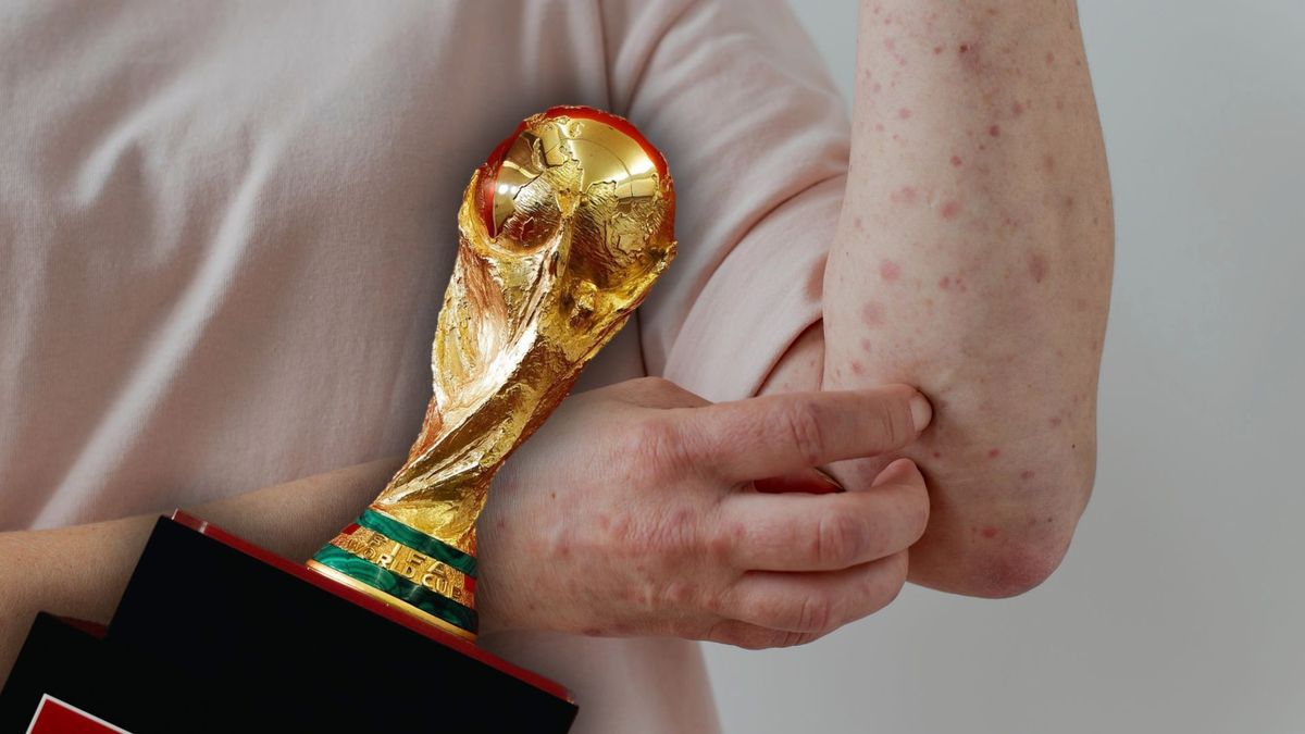 mundial 2026 sarampion bogota vacunacion viajeros alerta puntos salud inmunizacion niños colombia