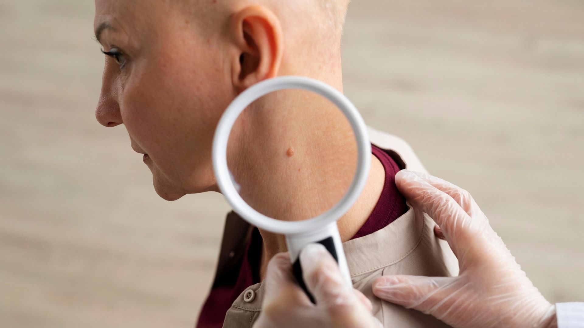 La detección temprana del cáncer de piel comienza con la observación de cambios en los lunares, explicó Eduardo Rivera Perdomo.